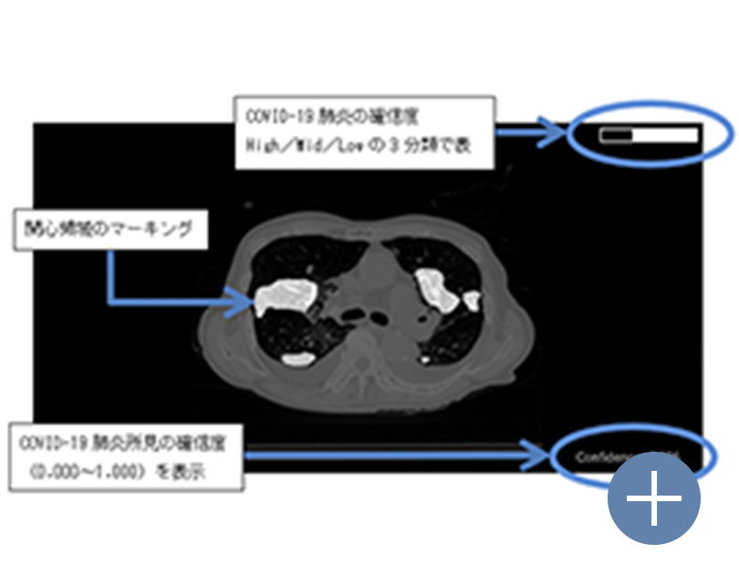 COVID-19肺炎画像解析プログラム Ali-M3