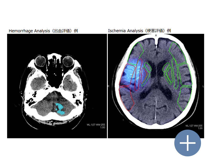 Stroke基本パッケージ